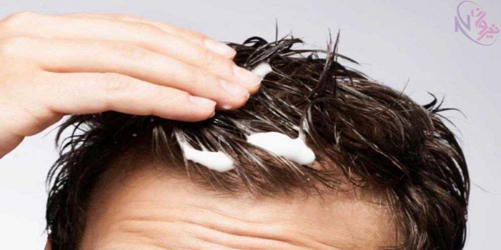 حالت دهنده مو آقایان